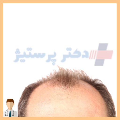 ریزش مو دکتر پرستیژ