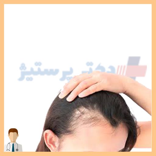 رفع ریزش مو زنان باردار دکتر پرستیژ